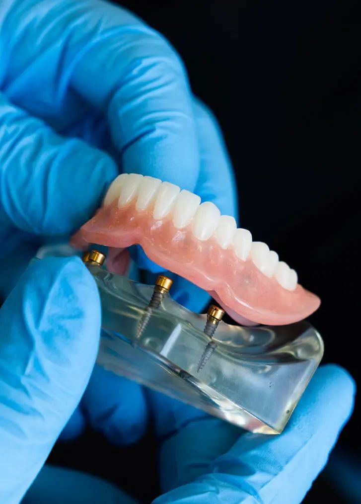 Dentures